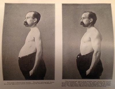 Picture of man who is obese on left and same man who is thinner on the right. Sample page from the chapter “Evils of Over-Exercise.
